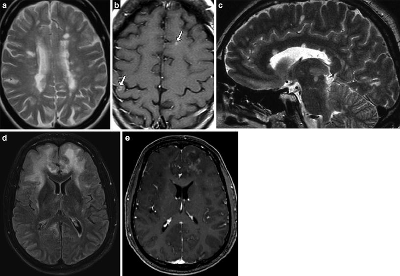 Spot The Diagnosis